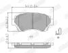 Превью - 572392J JURID Комплект тормозных колодок, дисковый тормоз (фото 2)
